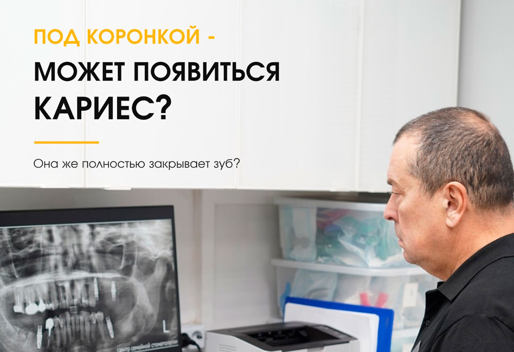 Под коронкой может появиться кариес? Она же полностью закрывает зуб