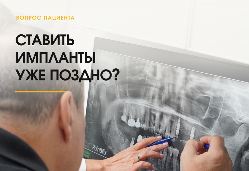 «В моём возрасте уже поздно ставить импланты»