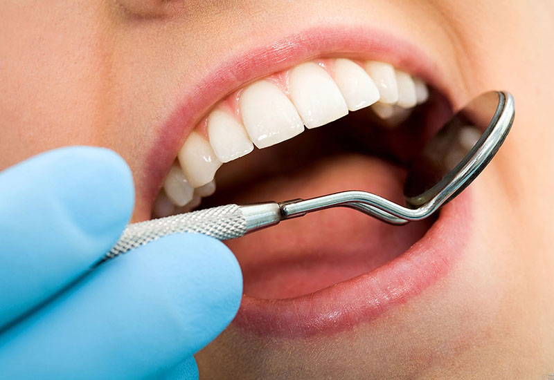 Почему выпадают пломбы из зуба