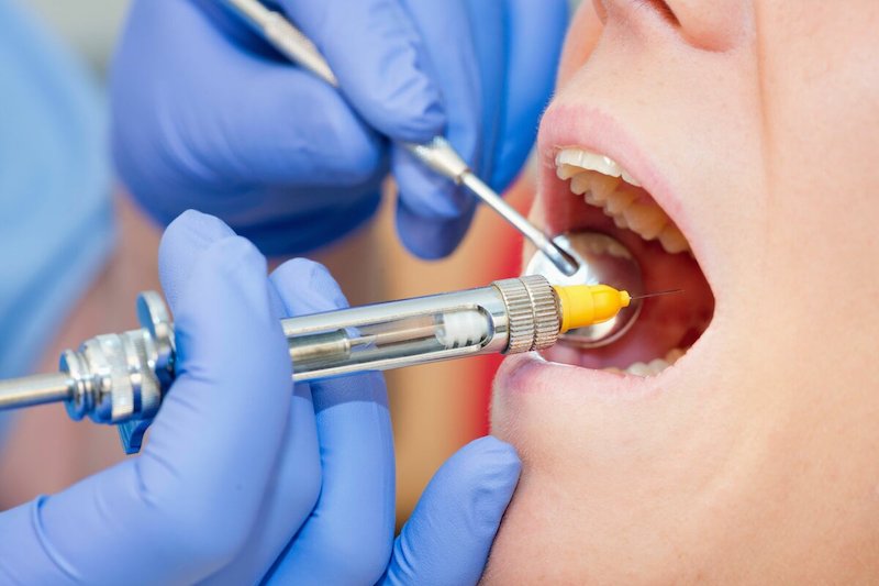 Инъекционные вмешательства в стоматологии