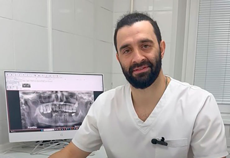 Зачем нужен хирургический шаблон при имплантации?